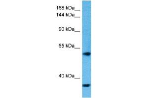 Host:  Rabbit  Target Name:  KIDINS220  Sample Tissue:  Human HT1080 Whole Cell lysates  Antibody Dilution:  1ug/ml (KIDINS220 antibody  (Middle Region))