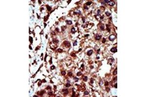 Image no. 1 for anti-Diacylglycerol Kinase, iota (DGKI) (C-Term) antibody (ABIN360602) (DGKI antibody  (C-Term))