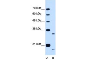 Western Blotting (WB) image for anti-Cell Cycle Progression 1 (CCPG1) antibody (ABIN2462985) (CCPG1 antibody)