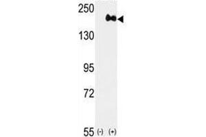 Western blot analysis of anti-HER2 antibody and 293 cell lysate (2 ug/lane) either nontransfected (Lane 1) or transiently transfected with the ERBB2 gene (2). (ErbB2/Her2 antibody  (AA 1227-1255))