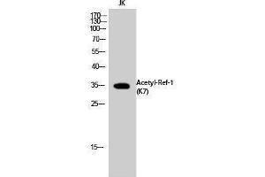 Western Blotting (WB) image for anti-Apurinic/Apyrimidinic Endonuclease 1 (APEX1) (acLys7) antibody (ABIN3172829) (APEX1 antibody  (acLys7))