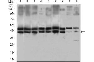 Immunofluorescence analysis of Hela cells using IL2RA antibody (green). (CD25 antibody  (AA 34-139))