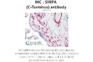 Image no. 1 for anti-Signal-Regulatory Protein alpha (SIRPA) antibody (ABIN1739273) (SIRPA antibody)