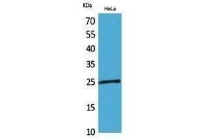 Periaxin antibody  (Internal Region)