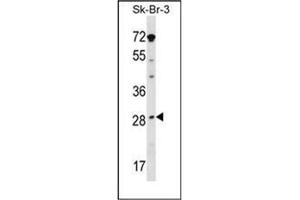 Western blot analysis in SK-BR-3 cell line lysates (35ug/lane) using STAR / STARD1 Antibody (Center) Cat. (STAR antibody  (Middle Region))