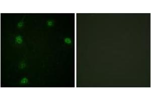 Immunofluorescence analysis of HeLa cells, using Cyclin E1 (Phospho-Thr77) Antibody.