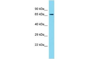 Western Blotting (WB) image for anti-Protein Phosphatase 1, Regulatory Subunit 37 (PPP1R37) (C-Term) antibody (ABIN2791654) (PPP1R37 antibody  (C-Term))