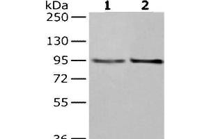 Western Blot analysis of Hela and K562 cells using NUP98 Polyclonal Antibody at dilution of 1/350 (NUP98 antibody)