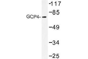 Image no. 1 for anti-Tubulin, gamma Complex Associated Protein 4 (TUBGCP4) antibody (ABIN317908) (TUBGCP4 antibody)