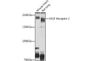 Western blot analysis of extracts of various cell lines, using VEGF Receptor 2 antibody (ABIN6132247, ABIN6142816, ABIN6142819 and ABIN6215074) at 1:500 dilution. (VEGFR2/CD309 antibody  (AA 20-200))