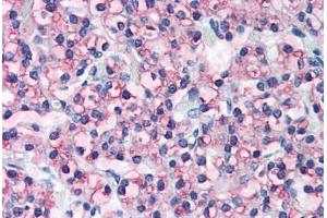 Human Parathyroid (formalin-fixed, paraffin-embedded) stained with PTH antibody ABIN305746 at 5 ug/ml followed by biotinylated anti-goat IgG secondary antibody ABIN481715, alkaline phosphatase-streptavidin and chromogen. (PTH antibody  (AA 71-115))