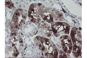 Image no. 1 for anti-Coagulation Factor XIII, A1 Polypeptide (F13A1) antibody (ABIN1498150) (F13A1 antibody)