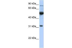 WB Suggested Anti-EIF2B1  Antibody Titration: 0. (EIF2B1 antibody  (C-Term))