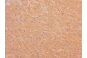 Figure. (TPSAB1 antibody  (AA 161-262))