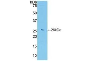 Detection of Recombinant GSTa4, Mouse using Polyclonal Antibody to Glutathione S Transferase A4 (GSTA4) (GSTA4 antibody  (AA 1-222))