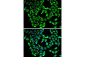 Immunofluorescence analysis of HeLa cell using ASIP antibody. (ASIP antibody)
