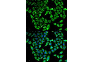 Immunofluorescence analysis of HeLa cell using ASIP antibody.