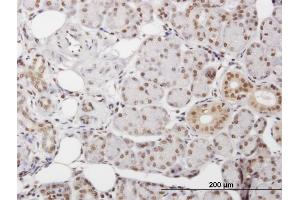 Immunoperoxidase of purified MaxPab antibody to DKC1 on formalin-fixed paraffin-embedded human salivary gland.