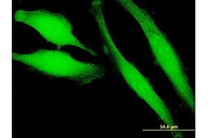 Immunofluorescence of purified MaxPab antibody to HRASLS3 on HeLa cell. (PLA2G16 antibody  (AA 1-162))