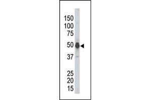 PHKG2 antibody  (N-Term)