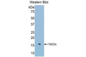 Western Blotting (WB) image for anti-Connective Tissue Growth Factor (CTGF) (AA 80-200) antibody (ABIN1858525) (CTGF antibody  (AA 80-200))