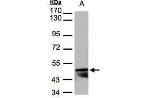 WB Image Sample(30 μg of whole cell lysate) A:HeLa S3, 7. (KRT14 antibody)