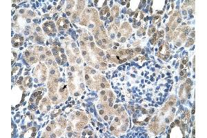 SLC19A1 antibody was used for immunohistochemistry at a concentration of 4-8 ug/ml to stain Epithelial cells of renal tubule (arrows) in Human Kidney. (SLC19A1 antibody)