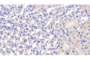 Detection of FUCa1 in Mouse Kidney Tissue using Polyclonal Antibody to Fucosidase Alpha L1, Tissue (FUCa1) (FUCA1 antibody  (AA 185-447))