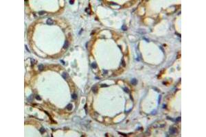 Used in DAB staining on fromalin fixed paraffin-embedded pancreas tissue (Tetraspanin 3 antibody  (AA 107-213))