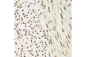 Immunohistochemistry (Paraffin-embedded Sections) (IHC (p)) image for anti-Heterogeneous Nuclear Ribonucleoprotein D (HNRNPD) (AA 1-306) antibody (ABIN6141905)