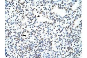 Image no. 1 for anti-Pogo Transposable Element with ZNF Domain (POGZ) (N-Term) antibody (ABIN203011) (POGZ antibody  (N-Term))