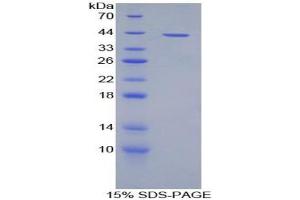 SDS-PAGE analysis of Rat Connexin 31 Protein. (Connexin 31 Protein)