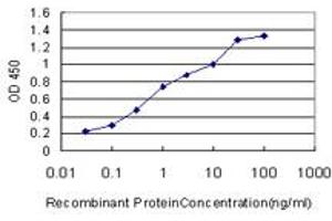 Detection limit for recombinant GST tagged RPS6KB1 is approximately 0. (RPS6KB1 antibody  (AA 416-525))