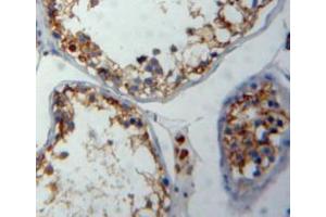 IHC-P analysis of testis tissue, with DAB staining. (FNBP1 antibody  (AA 348-529))
