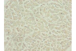 Immunohistochemistry of paraffin-embedded human heart tissue using ABIN7146448 at dilution of 1:100 (CAMK2D antibody  (AA 1-260))