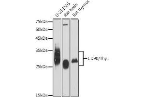Western blot analysis of extracts of various cell lines, using CD90/Thy1 antibody (ABIN6129735, ABIN6148554, ABIN6148555 and ABIN7101405) at 1:1000 dilution. (CD90 antibody)