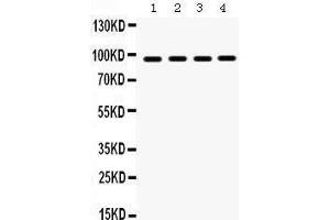 Western Blotting (WB) image for anti-Heat Shock Protein 90kDa beta (Grp94), Member 1 (HSP90B1) (AA 43-221) antibody (ABIN3042463)