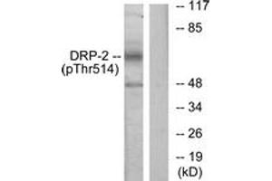 Western blot analysis of extracts from NIH-3T3 cells treated with PMA 125ng/ml 30', using DRP-2 (Phospho-Thr514) Antibody. (DRP2 antibody  (pThr514))