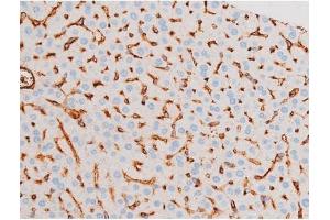 ABIN6267575 at 1/200 staining Mouse liver tissue sections by IHC-P.