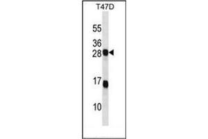 Western blot analysis of KDELR2 Antibody (C-term) in T47D cell line lysates (35ug/lane).