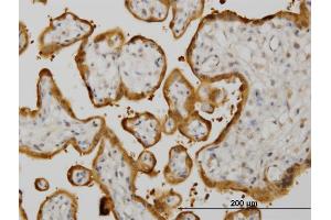 Immunoperoxidase of monoclonal antibody to HSPB8 on formalin-fixed paraffin-embedded human placenta. (HSPB8 antibody  (AA 97-196))
