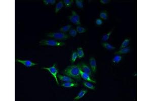 Immunofluorescent analysis of HepG2 cells using ABIN7173221 at dilution of 1:100 and Alexa Fluor 488-congugated AffiniPure Goat Anti-Rabbit IgG(H+L) (TMEM44 antibody  (AA 269-439))