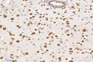 Immunohistochemistry analysis of paraffin-embedded mouse spinal cord using,SET (ABIN7075583) at dilution of 1: 10000 (SET/TAF-I antibody)