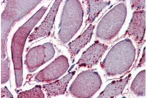 Skeletal muscle, Human: Formalin-Fixed, Paraffin-Embedded (FFPE) (NEK7 antibody  (N-Term))