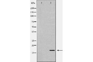 Western blot analysis of Hela  lysate using TGFA antibody. (TGFA antibody  (C-Term))