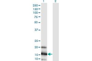 Western Blot analysis of LOC402176 expression in transfected 293T cell line by LOC402176 monoclonal antibody (M03), clone 3E7. (RPL21P44 antibody  (AA 1-136))