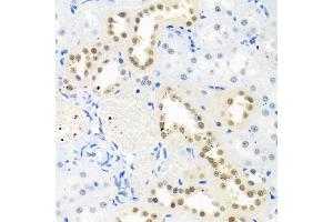 Immunohistochemistry of paraffin-embedded rat kidney using THOC1 antibody (ABIN5974800) at dilution of 1/100 (40x lens). (THOC1 antibody)