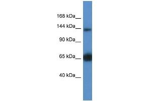 WB Suggested Anti-Rapgef2 Antibody   Titration: 1. (RAPGEF2 antibody  (Middle Region))