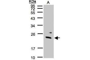 WB Image Sample(30 μg of whole cell lysate) A:293T 12% SDS PAGE antibody diluted at 1:1000 (GUK1 antibody)
