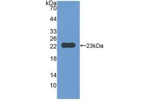 Western blot analysis of recombinant Mouse IAP.
